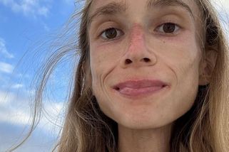 Roky jedla jen ovoce, ale komunita ji uznávala: Teď Karolínu našli mrtvou v hotelovém pokoji